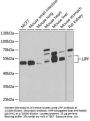 Gastric Triacylglycerol Lipase (LIPF) Antibody