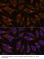 Anterior Gradient Protein 2 Homolog (AGR2) Antibody
