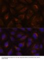 Anterior Gradient Protein 2 Homolog (AGR2) Antibody