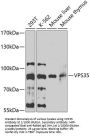 Vacuolar Protein Sorting-Associated Protein 35 (VPS35) Antibody