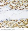 N-Alpha-Acetyltransferase 60 (NAA60) Antibody