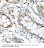 N-Alpha-Acetyltransferase 60 (NAA60) Antibody