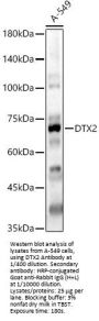 Probable E3 Ubiquitin-Protein Ligase DTX2 (DTX2) Antibody