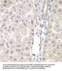 Probable E3 Ubiquitin-Protein Ligase DTX2 (DTX2) Antibody