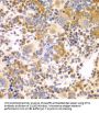 Probable E3 Ubiquitin-Protein Ligase DTX2 (DTX2) Antibody