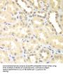 Probable E3 Ubiquitin-Protein Ligase DTX2 (DTX2) Antibody