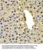 Probable E3 Ubiquitin-Protein Ligase DTX2 (DTX2) Antibody