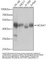 Acetyl-CoA Acetyltransferase 1 (ACAA1) Antibody