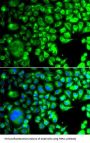 TATA Box-Binding Protein-Like Protein 1 (TBPL1) Antibody