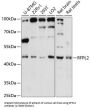 Ret Finger Protein-Like 2 (RFPL2) Antibody