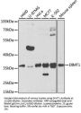 Probable Dimethyladenosine Transferase (DIMT1) Antibody