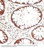Keratin 13 (KRT13) Antibody