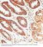 Keratin 13 (KRT13) Antibody