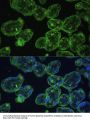 Keratin 13 (KRT13) Antibody