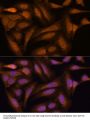 Mitogen-Activated Protein Kinase Kinase 3 (MAP2K3) Antibody