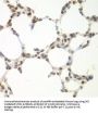 Serine/threonine-Protein Kinase VRK1 (VRK1) Antibody