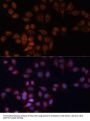 A Disintegrin And Metalloprotease 15 (ADAM15) Antibody