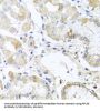 Ribosomal Protein L36 (RPL36) Antibody
