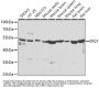 Inhibitor of Growth Protein 1 (ING1) Antibody