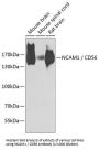 Neural Cell Adhesion Molecule 1 / CD56 (NCAM1) Antibody