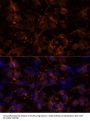 Neural Cell Adhesion Molecule 1 / CD56 (NCAM1) Antibody