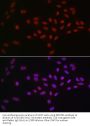 ATP-Dependent RNA Helicase DDX39A (DDX39A) Antibody