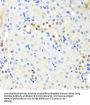 ATP-Dependent RNA Helicase DDX39A (DDX39A) Antibody