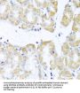 ATP-Dependent RNA Helicase DDX39A (DDX39A) Antibody