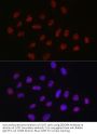 ATP-Dependent RNA Helicase DDX39A (DDX39A) Antibody
