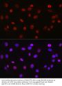 ATP-Dependent RNA Helicase DDX39A (DDX39A) Antibody