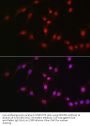 ATP-Dependent RNA Helicase DDX39A (DDX39A) Antibody