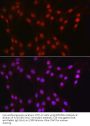 ATP-Dependent RNA Helicase DDX39A (DDX39A) Antibody
