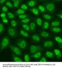 Telomeric Repeat Binding Factor 2 Interacting Protein (TERF2IP) Antibody