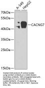 Voltage-Dependent Calcium Channel Gamma-7 Subunit (CACNG7) Antibody