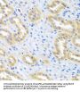Bone Morphogenetic Protein 3 (BMP3) Antibody