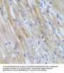 Bone Morphogenetic Protein 3 (BMP3) Antibody