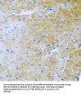 Bone Morphogenetic Protein 3 (BMP3) Antibody