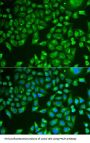 Pancreatic Triacylglycerol Lipase (PNLIP) Antibody