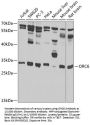 Origin Recognition Complex Subunit 6 (ORC6) Antibody