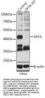 DNA Fragmentation Factor Subunit Alpha (DFFA) Antibody