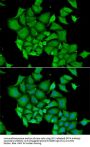 DNA Fragmentation Factor Subunit Alpha (DFFA) Antibody