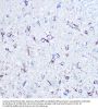 Amyloid Beta Precursor Like Protein 1 (APLP1) Antibody