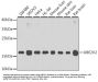 Ubiquitin Conjugating Enzyme E2 V2 (UBE2V2) Antibody