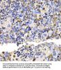 Ubiquitin Conjugating Enzyme E2 V2 (UBE2V2) Antibody