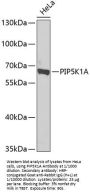 Phosphatidylinositol-4-Phosphate 5-Kinase Type 1 Alpha (PIP5K1A) Antibody