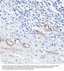 Mucosal Addressin Cell Adhesion Molecule 1 (MADCAM1) Antibody