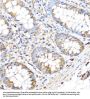 Matrix Metalloproteinase 17 (MMP17) Antibody