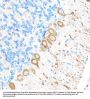 Matrix Metalloproteinase 17 (MMP17) Antibody