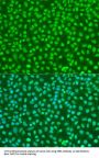Nibrin (NBN) Antibody