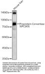 Proprotein Convertase Subtilisin/Kexin Type 9 (PCSK9) Antibody
